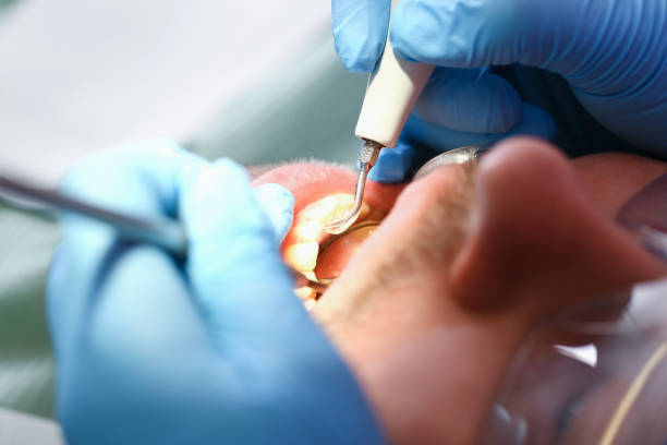 Best Cracked Tooth Emergency Dentist  in Presidential Lakes Estates, NJ