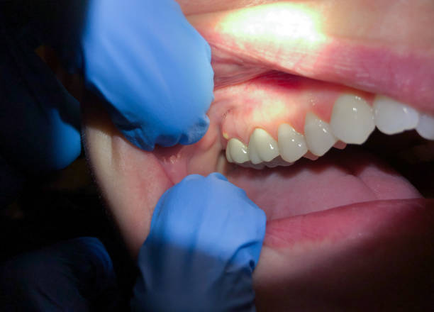 Best Emergency Gum Pain Relief  in Presidential Lakes Estates, NJ